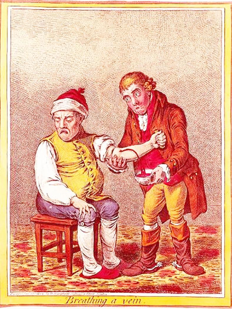 A Superb & Most Scarce King George IIIrd Period Therapeutic Phlebotomy Mechanical Instrument, A Scarifyer Of Superb Quality by Ferguson of London. A Pistol Action To Instantaneously Release & Retract 12 Rotating Blades to Slice The Skin For Blood Letting
